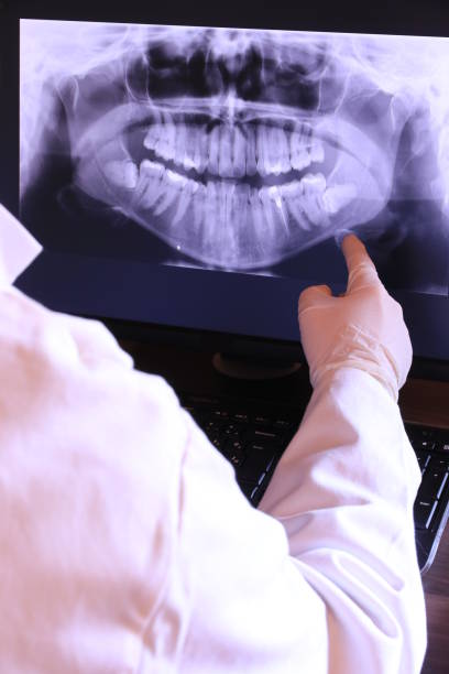 Best Broken or Cracked Tooth Emergency Dentist in Spring Ridge, MD